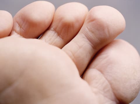 When your second toe is longer than the first, that’s Morton’s toe.