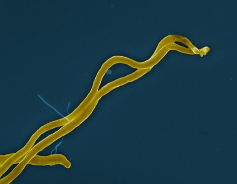 An extreme close-up of ‘Borellia burgdorferi’ (digitally colored gold), the spirochete bacterium that causes Lyme disease. 