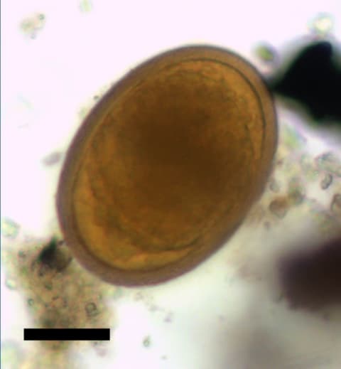 A roundworm egg