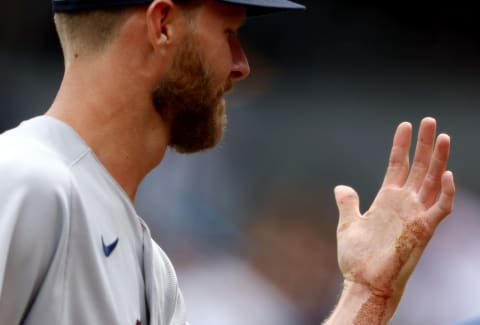 NEW YORK, NEW YORK – JULY 17: Chris Sale #41 of the Boston Red Sox leaves the field with a dislocated pinky finger after getting hit by a line drive from Aaron Hicks of the New York Yankees in the first inning at Yankee Stadium on July 17, 2022 in the Bronx borough of New York City. (Photo by Elsa/Getty Images)